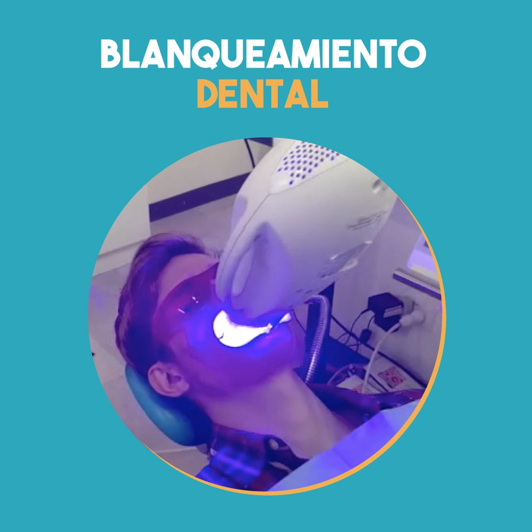 Blanqueamiento dental Costa Rica